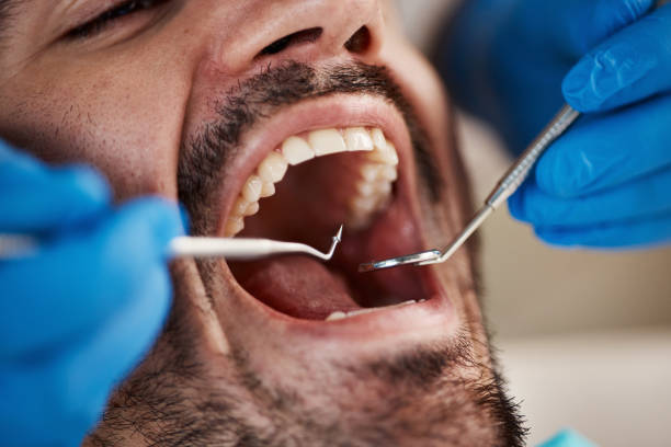 Dental X-Rays and Imaging in Union, NJ